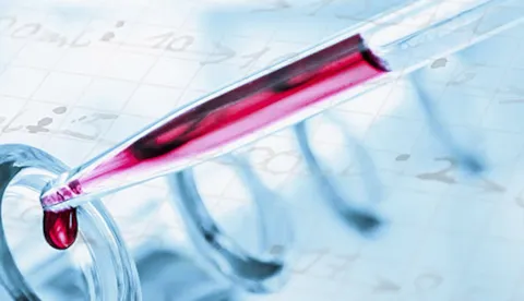 Gerenciando o Programa de Risco de Infecção